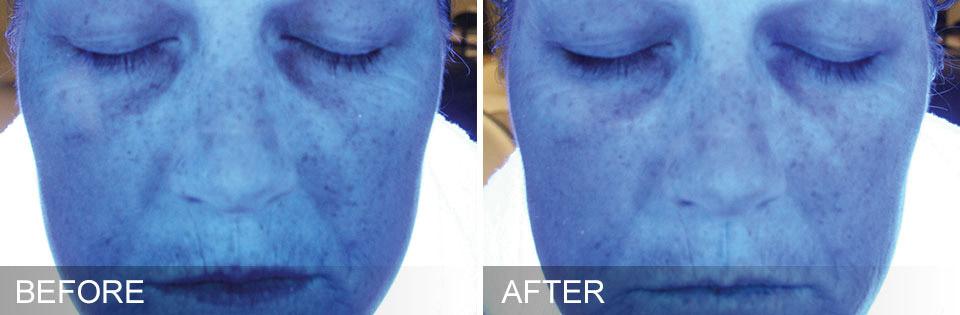 before-after-hydration-web